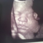 Baby Garza :)