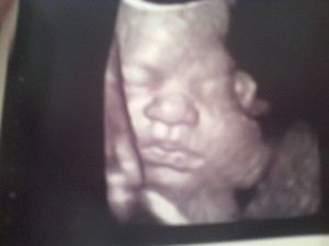 Baby Garza :)